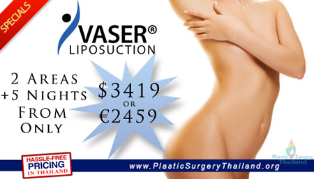 Vaser-Lipo-Special-2014-PST