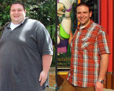 Rny-Weightloss-surgery-thailand-Before-After-joe