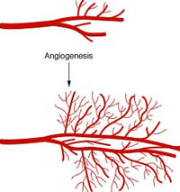 angiogenesis