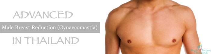 male-chest-reduction-promotion-thailand