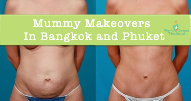 mommy-makeovers-in-thailand