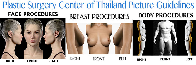 Plastic Surgery Center Thailand Picture Guideline