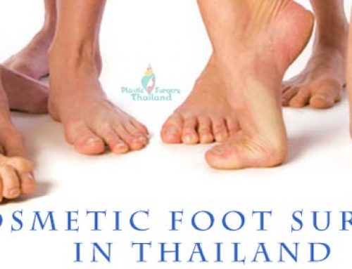 Cosmetic Foot Surgery Brachymetatarsia Hallux Valgus