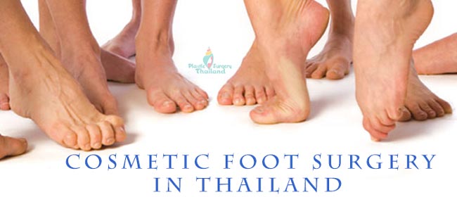 cosmetic-foot-surgery-bunion-removal