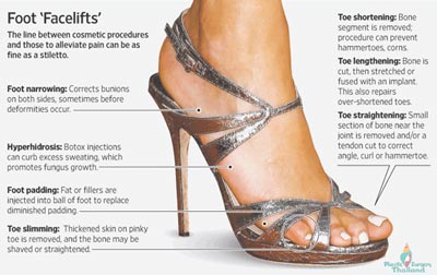foot-facelift-loub-job-cosmetic-foot-surgery-wide-feet